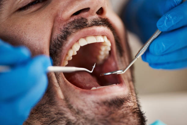 Best Dental Exams and Cleanings  in Moodys, OK